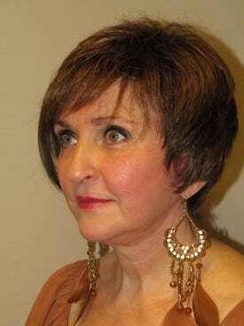 68 year old Facelift, Upper and Lower eyelift and necklift.