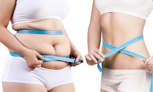 Medical Weight Loss Solutions in Buffalo, NY