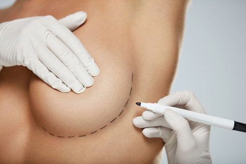 Are There Risks Associated With a Breast Lift Aesthetic Associates Centre for Plastic Surgery Buffalo NY