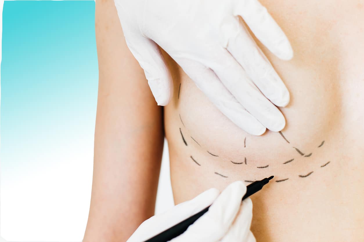 Is Breast Lift the Glow Up for Natural Softness and Firm Lift Look?