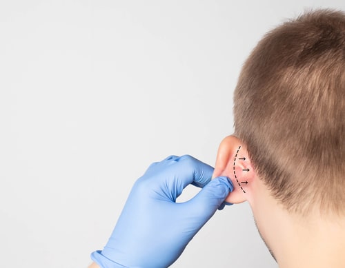 Ear Surgery in Buffalo, NY