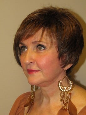 68 year old Facelift, Upper and Lower eyelift and necklift.