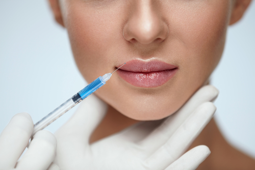 Cupid's Bow Treatment in Buffalo, NY | Define & Enhance Your Lips
