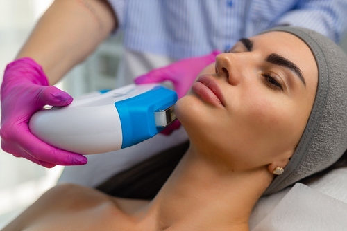 IPL Photofacial in Buffalo, NY | Target Sun Spots, Redness & More!